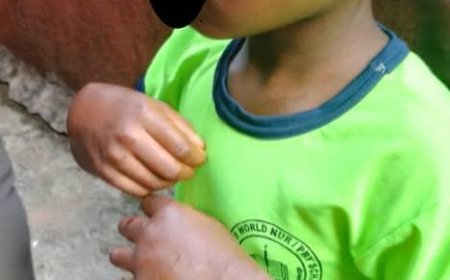 Anambra Police Arrest 25 Year-Old Mother For Brutalizing 8 Year-Old Maid