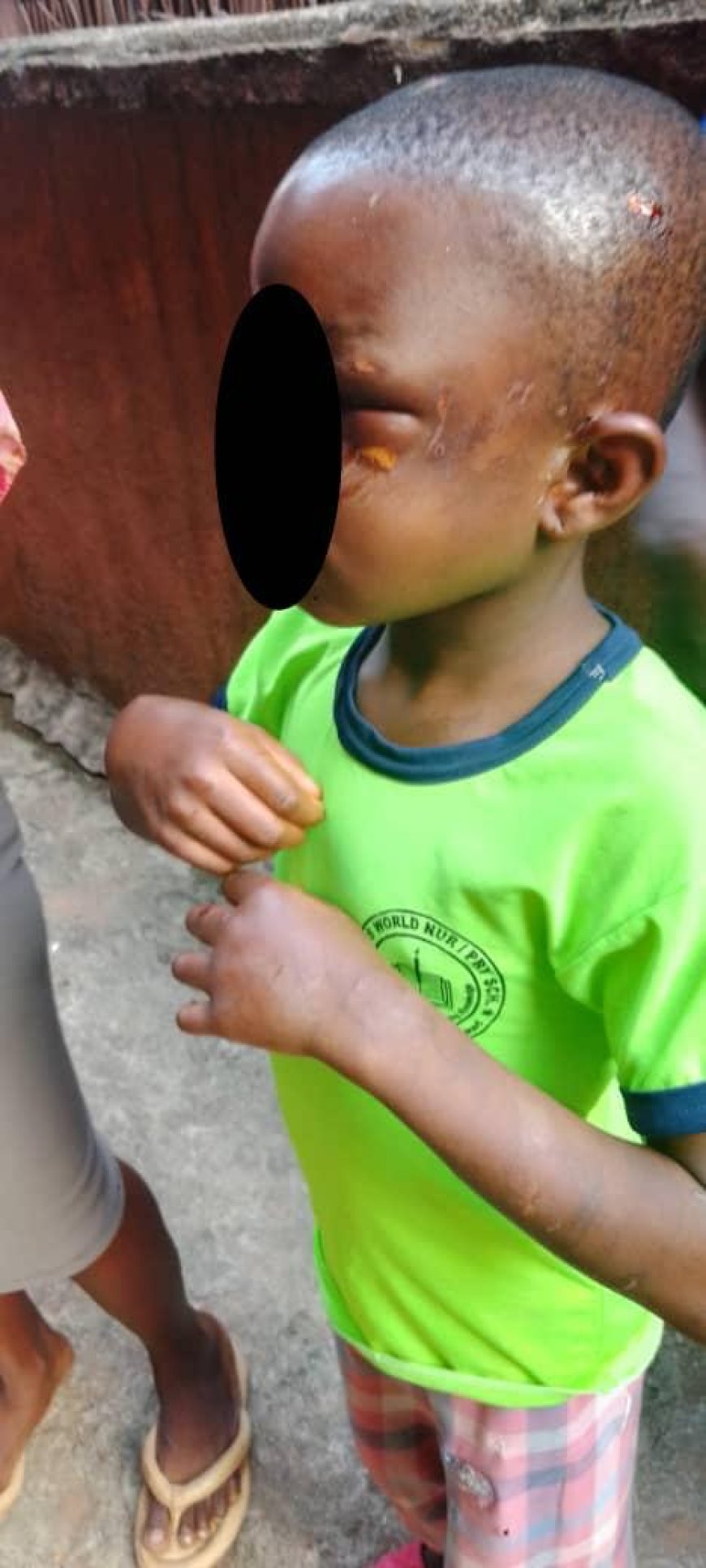 Anambra Police Arrest 25 Year-Old Mother For Brutalizing 8 Year-Old Maid