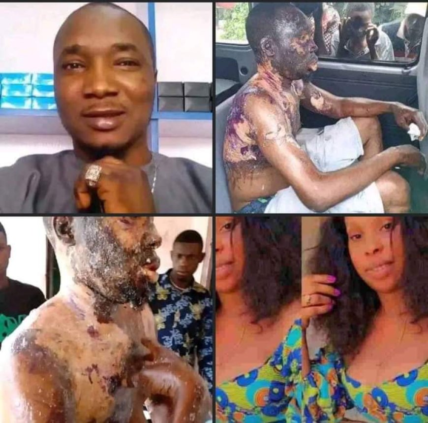 Rivers Housewife Bathes Husband With Hot Oil