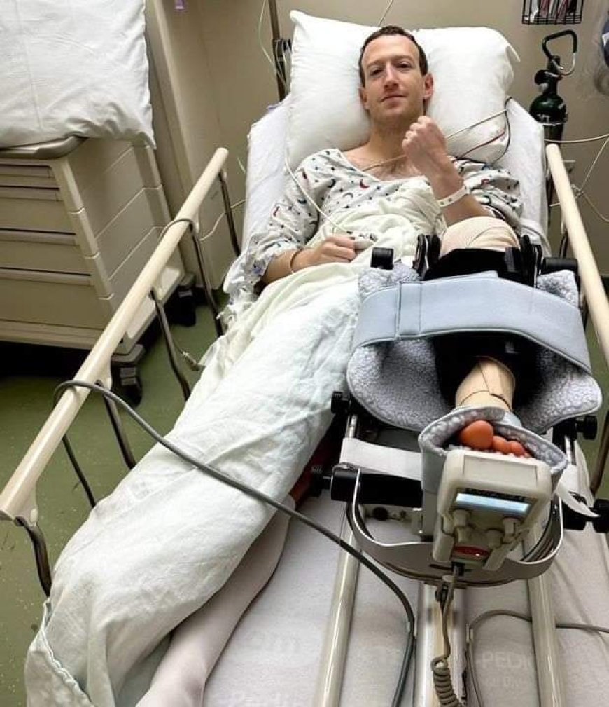Zuckerberg Undergoes Knee Surgery