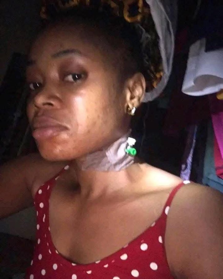 Influencer Arrested for Dubious Crowd Funding, Fake Surgery Claims
